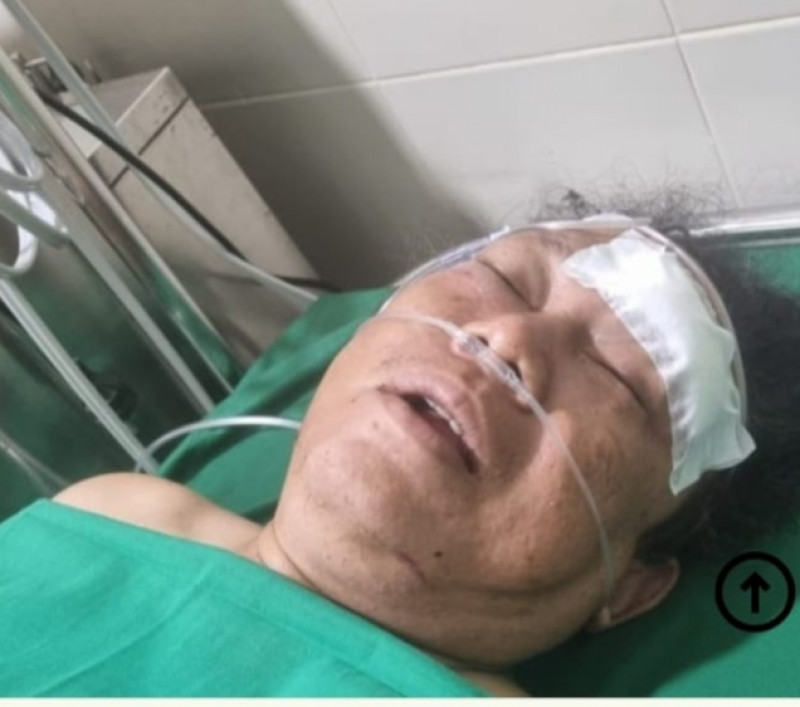 PW IWO Aceh Bantah Korban Pembacokan Adalah Anggota, Minta Media Faktanews.co.Id Klarifikasi Judul Berita